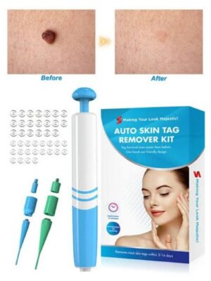 SKIN TAG REMOVER