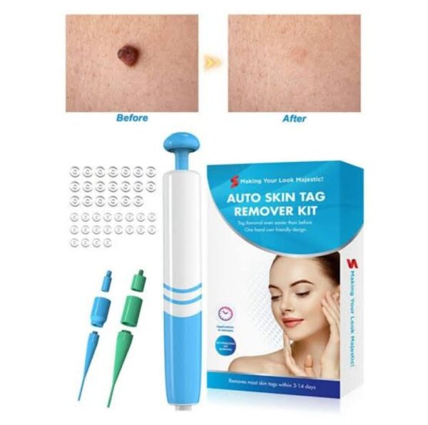 SKIN TAG REMOVER